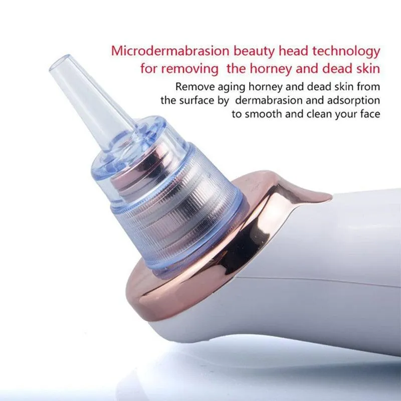 Blackhead Remover Vacuum Suction Cleaner